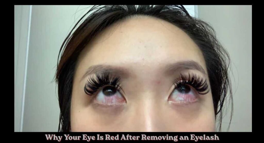 How to Get an Eyelash Out of Your Eye Fast & Safely 4 Why Your Eye Is Red After Removing an Eyelash